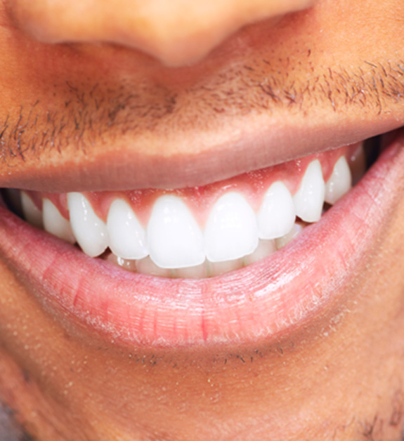 Closeup of a man smiling