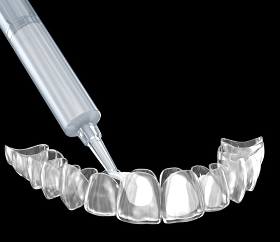 Digital illustration or clear trays